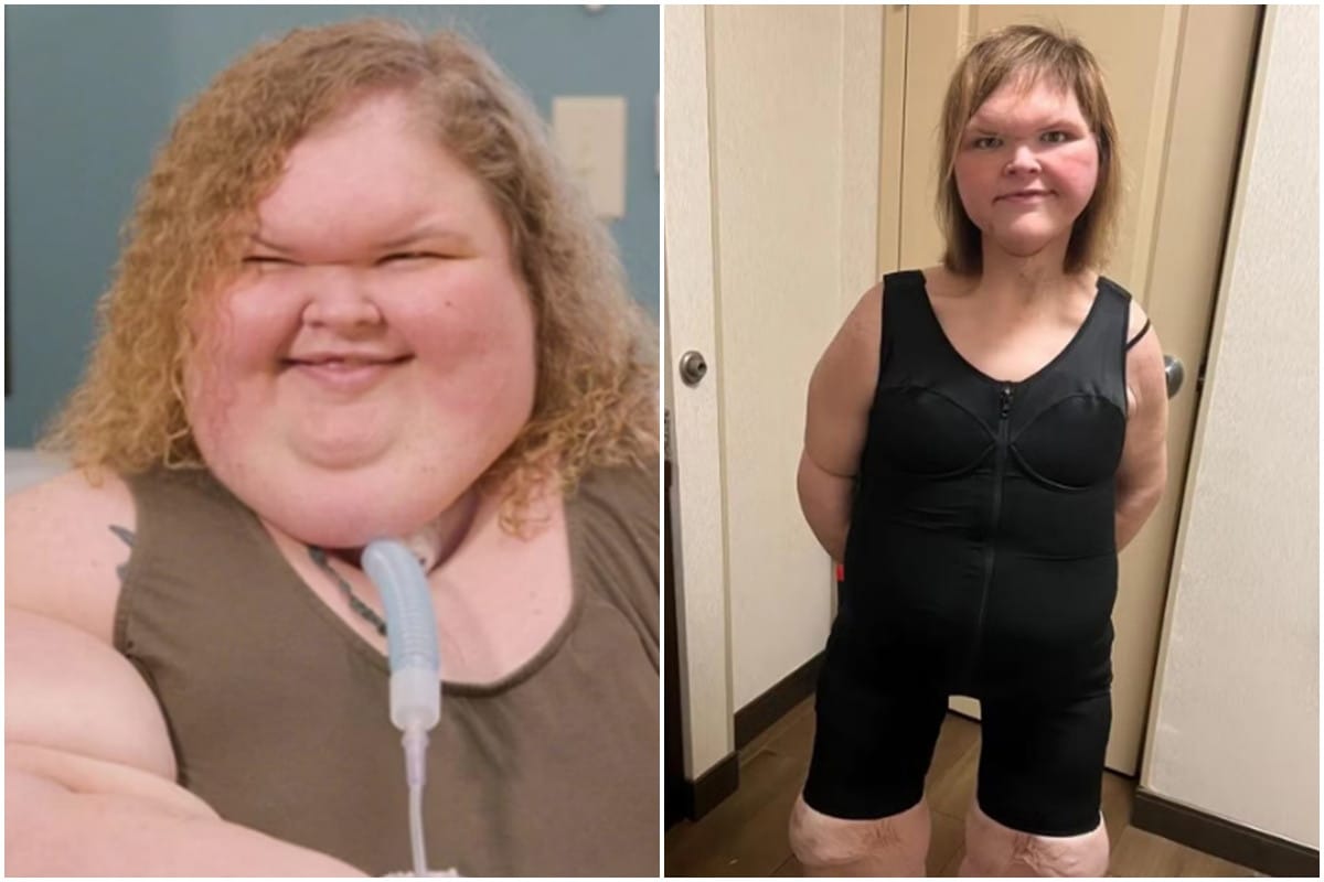 Emagrecimento Real: Como uma Estrela de TV Perdeu Mais de 200 kg e Transformou sua Vida