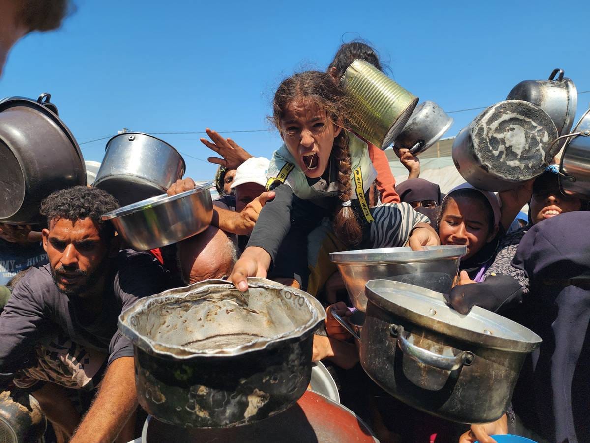 ONU Alerta: 20% das Crianças na Cidade de Gaza Estão Desnutridas