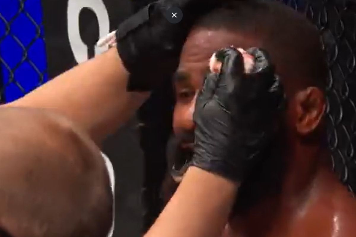 Joelhada no UFC: Lutador é ferido após nocaute técnico e cena choca a web