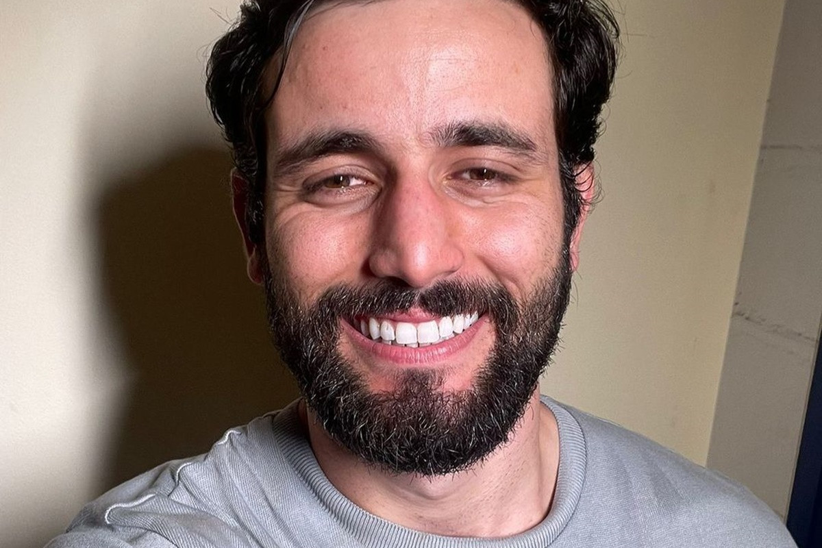 Rinoplastia do Ex-BBB: Resultados Surpreendentes e Dicas Essenciais