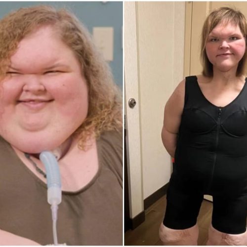 Emagrecimento Real: Como uma Estrela de TV Perdeu Mais de 200 kg e Transformou sua Vida