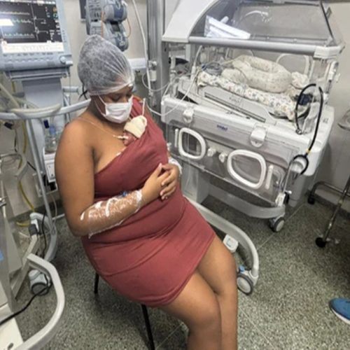 Gravidez de Quadrigêmeos: A Feito Inédita de Jovem em Salvador