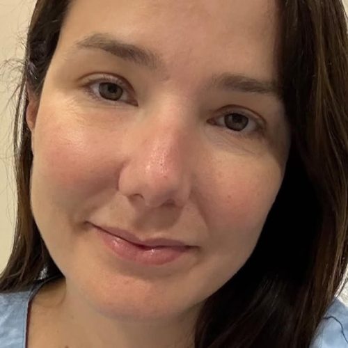 infecção no rosto: quando se torna uma emergência médica?