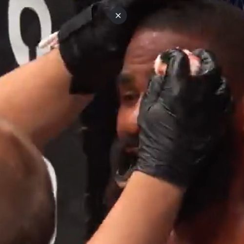 Joelhada no UFC: Lutador é ferido após nocaute técnico e cena choca a web