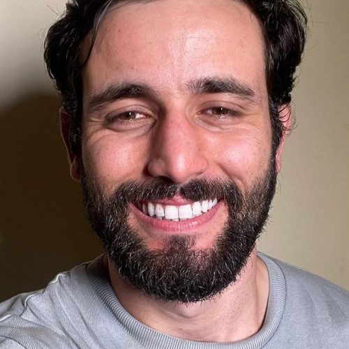 Rinoplastia do Ex-BBB: Resultados Surpreendentes e Dicas Essenciais